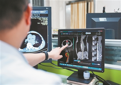 醫生通過iAorta進行病情診斷。 受訪單位供圖