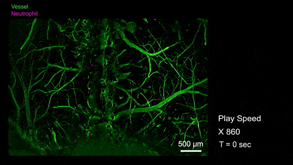 XpȫƤӷμˮƽ߷AW΢Ź̖