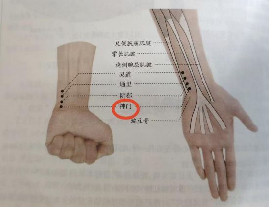 圖中標紅為神門穴。（受訪者供圖）